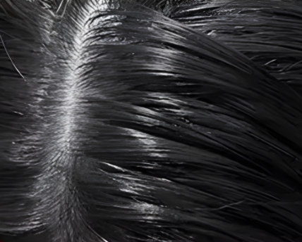 Scalp sensitivity and excessive dandruff