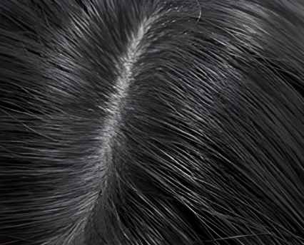 Healthy and clean scalp