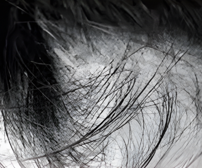 Hair follicles are sparse and prone to breakage